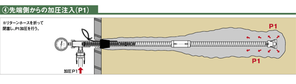 4.先端側からの加圧注入（P1）