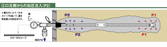 5.口元側からの加圧注入（P２）