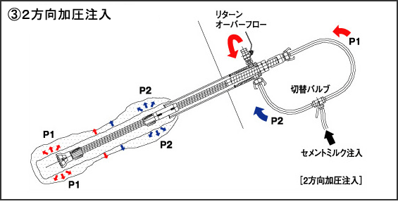 3.2方向加圧注入